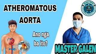 Ano ang Atheromatous Aorta [upl. by Iatnohs]