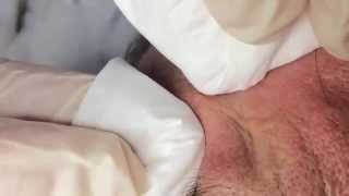 How To Remove a Whitehead Soft Sebum [upl. by Teece235]