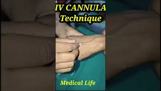 बिगो​ लगाने का नया तरीकाhow​ to insert cannulaivcannula​ lagane ka shot💉thickytshort​ youtube [upl. by Sean]