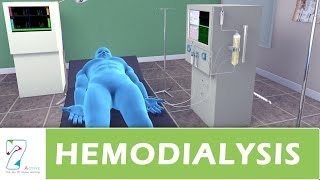 Hemodialysis [upl. by Iraam]