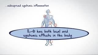 The role of interleukin6 in autoimmune diseases [upl. by Eleazar]