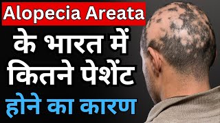 बालो में कीड़ा लगने की बीमारी क्यो बढ़ती जा रही है भारत मे  Alopecia Areata [upl. by Raffaj247]