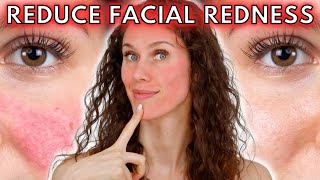 🔴 5 Reasons Your Face Is Always Red Rosacea to Dermatographia amp Everything Inbetween [upl. by Dru]