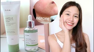 iUNIK Centella Calming Gel Cream  iUNIK Tea Tree Relief Serum Review  iUNIK honest review ph [upl. by Posehn]