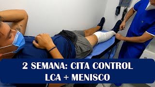 Ligamento cruzado anterior y Menisco2 semanaCita control [upl. by Mharba]