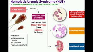 Hemolytic uremic syndrome  HUS  mrcpch Recall Communication [upl. by Anhpad441]