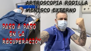 ARTROSCOPIA Rodilla Menisco Paso a Paso en la Recuperación artroscopia roturamenisco [upl. by Radbun613]