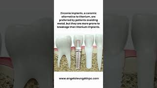 Titanium vs Zirconia Dental Implants Which One Wins dentalimplant dentalimplants smilemakeover [upl. by Ronile]