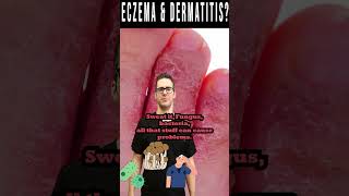 Dermatitis amp Eczema Dry Itchy Skin or Rash not Better [upl. by Atinele]