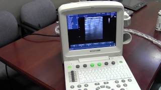 Portable Color Ultrasound  Edan U50 [upl. by Orling]