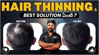 AskDrJohnWatts  HAIR THINNING కి BEST SOLUTION ఏంటి   Hair Doctor Explains [upl. by Preuss]