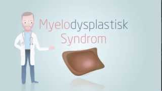 Myelodysplastic Syndromes or MDS [upl. by Normak]