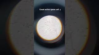 Microscope semen slid cout active cell  and pus cell dmlt patholgy medicalcollegelife foryou [upl. by Oza]