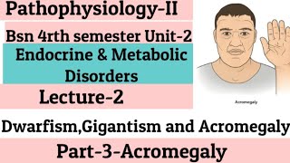 AcromegalyUnit2Endocrine amp Metabolic DisordersLecture2DwarfismGigantism AcromegalyPart3 [upl. by Rik]