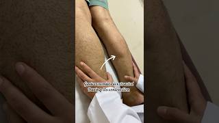 Gastrocnemius muscle tear physiotherapy dryneedling rehab musclestrengthening drvidhikaushik [upl. by Rainie170]