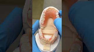 Upper and Lower Partials EnvisiontecMain envisiontec lsk121shorts dentist teeth [upl. by Aisnetroh]