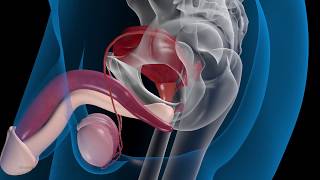 3DAnimation erklärt ProstataOperation Schematische 3D Animation [upl. by Eiggep]