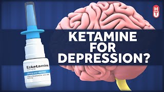 Ketamine as a Treatment for Depression [upl. by Ailecara415]