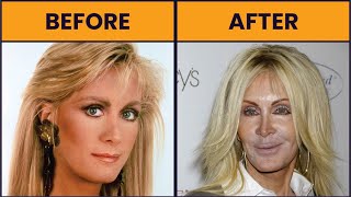 Top 10 PLASTIC SURGERY FAILURES [upl. by Yrrah]