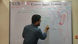 Pediatric cardiac defects  Acyanotic amp Cyanotic [upl. by Lacim758]