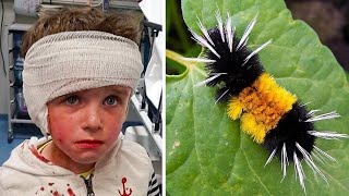 Cette Chenille Semble Inoffensive Mais Cet Enfant De 4 Ans A Été Hospitalisé Après L’avoir Touchée [upl. by Zebulon475]