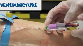 Venipuncture  How to take Blood  OSCE Guide old version  UKMLA  CPSA [upl. by Neelik]