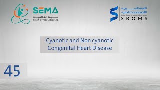 Cyanotic and non cyanotic Congenital heart disease  الدكتور أنس سلقيني [upl. by Pineda]