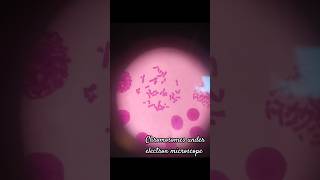 Genetic lab chromosomes viral trending viralvideo viralshorts laboratory knowledge 2024 new [upl. by Belden71]