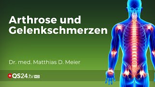 Autonomes Nervensystem Verursacher von Schmerzen aber auch Heiler  Dr med M D Meier  QS24 [upl. by Ainotna]