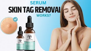 Serum Skin Tag Removal  Skinfix Skin Tag Remover [upl. by Egbert]