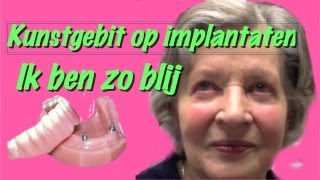 Kunstgebit op implantatenhet klikgebit gemaakt in Amsterdam Zuidoost [upl. by Shaeffer620]