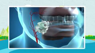 How Nicorette Works [upl. by Edualcnaej634]