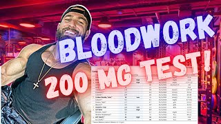 WHAT TO EXPECT ON 200 mg TESTOSTERONE per week  Bloodwork and How I feel after 4 months on 200mg [upl. by Ilana]