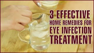 3 Easy amp Effective Home Remedies For EYE INFECTION TREATMENT [upl. by Er306]