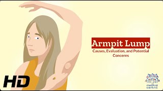 Unveiling the Mystery Understanding Armpit Lumps [upl. by Lekzehcey]