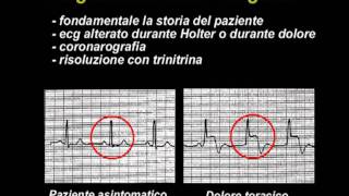 Angina pectoris [upl. by Esinrahc]