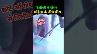 Normal delivery में छोटा ऑपरेशन chotaoperation episiotomy [upl. by Maxima]