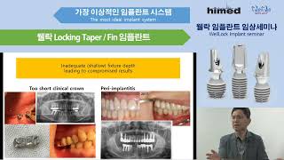 Subcrestal Placement  Biologic integration and implant design [upl. by Haynes]