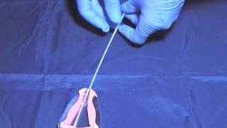 Endometrial Biopsy [upl. by Grefe]