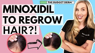 Minoxidil For Hair Loss  Everything you need to know [upl. by Valeta140]