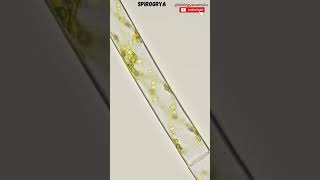 Spirogyra Under Microscope🔬 Filamentous alga  spirogyra biologyexams4u [upl. by Forrester]