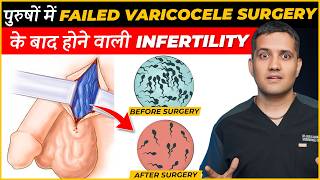 Can Varicocele Embolisation Be Useful For Male Infertility  Dr Gaurav Gangwani IR [upl. by Lexis]