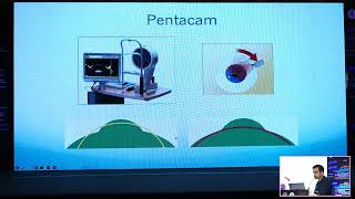 Pentacam Imaging  Dealing with the nuances in imaging by Dr Sahil GOEL [upl. by Ecnerual655]