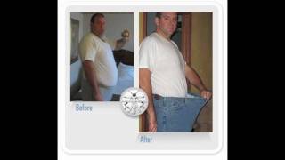 I LOST 140 POUNDS 10 stone  Gastric Sleeve Surgery [upl. by Dianuj]