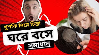 how to remove dandruff from hair home remedies। খুশকি দূর করার ঘরোয়া পদ্ধতি । dandruff removal [upl. by Hubble]