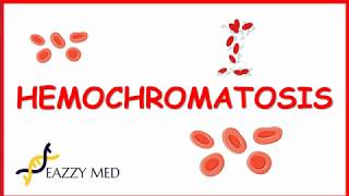 Hemochromatosis causespathophysiologysigns and symptomsdiagnosis and treatment [upl. by Faustena340]