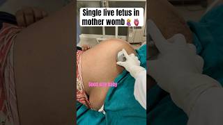 Fetus in mother wombfetal heart soundviral [upl. by Wolsniw]