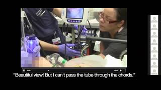 Mastering GlideScope Intubations with Dr Laurie Robichaud [upl. by Darb988]