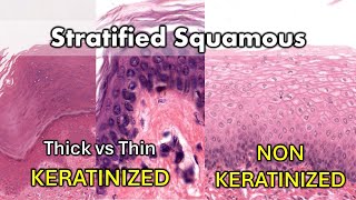 keratinized vs nonkeratinzed [upl. by Eiramave658]