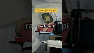 Efek samping Radioterapi cancer radiotherapy dokterkankerlampung shorts reels fyp [upl. by Gaye188]